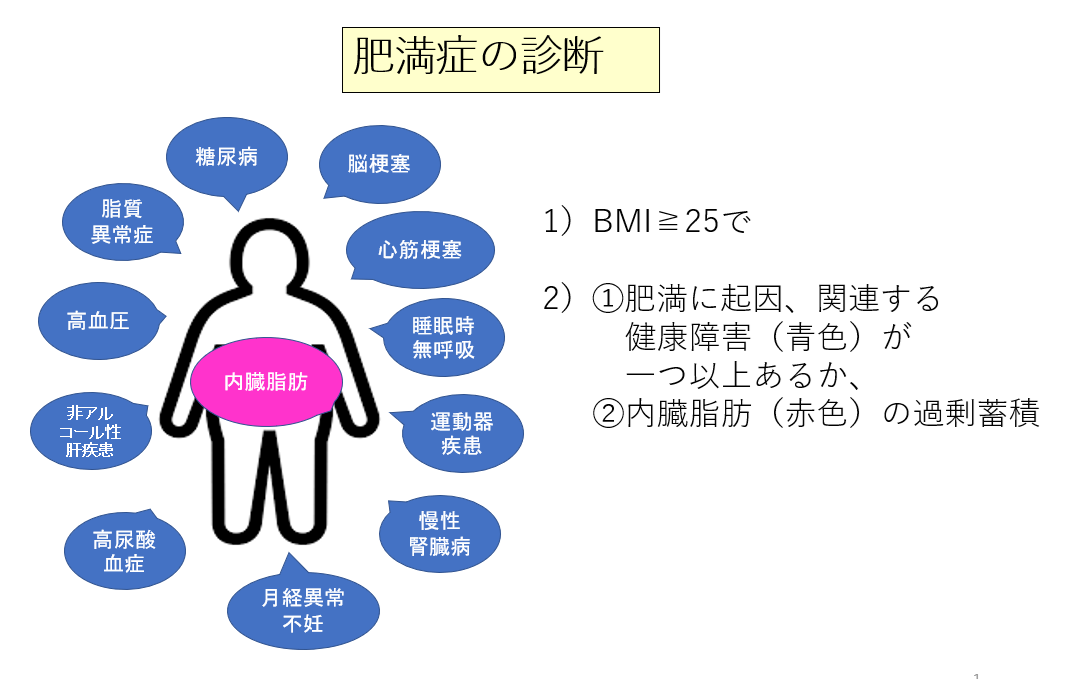 リレーコラム「教えて！肥満症」<br>第1回 肥満症診断基準制定25周年