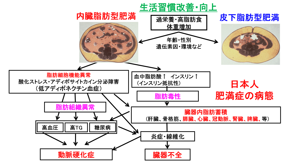 リレーコラム「教えて！肥満症」<br>第2回 温故知新；日本人の肥満症