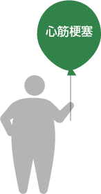 心筋梗塞